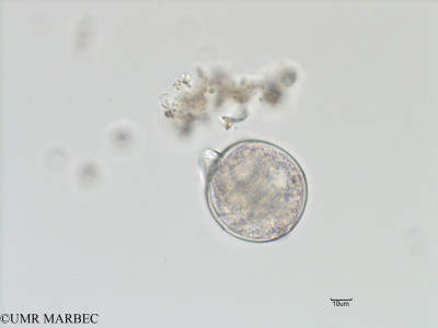 phyto/Bizerte/bizerte_bay/RISCO November 2015/Blepharocysta sp1 (Baie_T5-C3-dino cf p.meunieri-7).tif(copy)_thumb.jpg